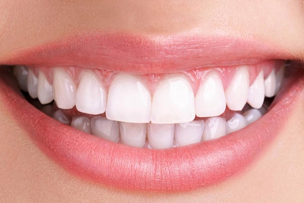 Những vấn đề liên quan tới giá bọc răng sứ